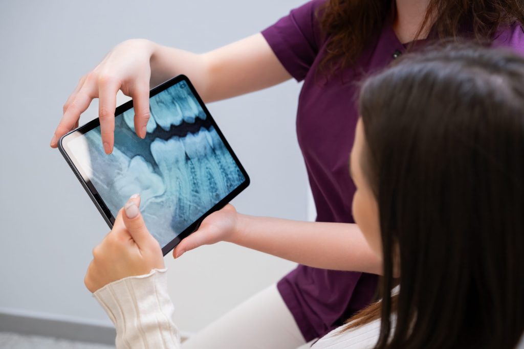 Emergency Tooth Extraction