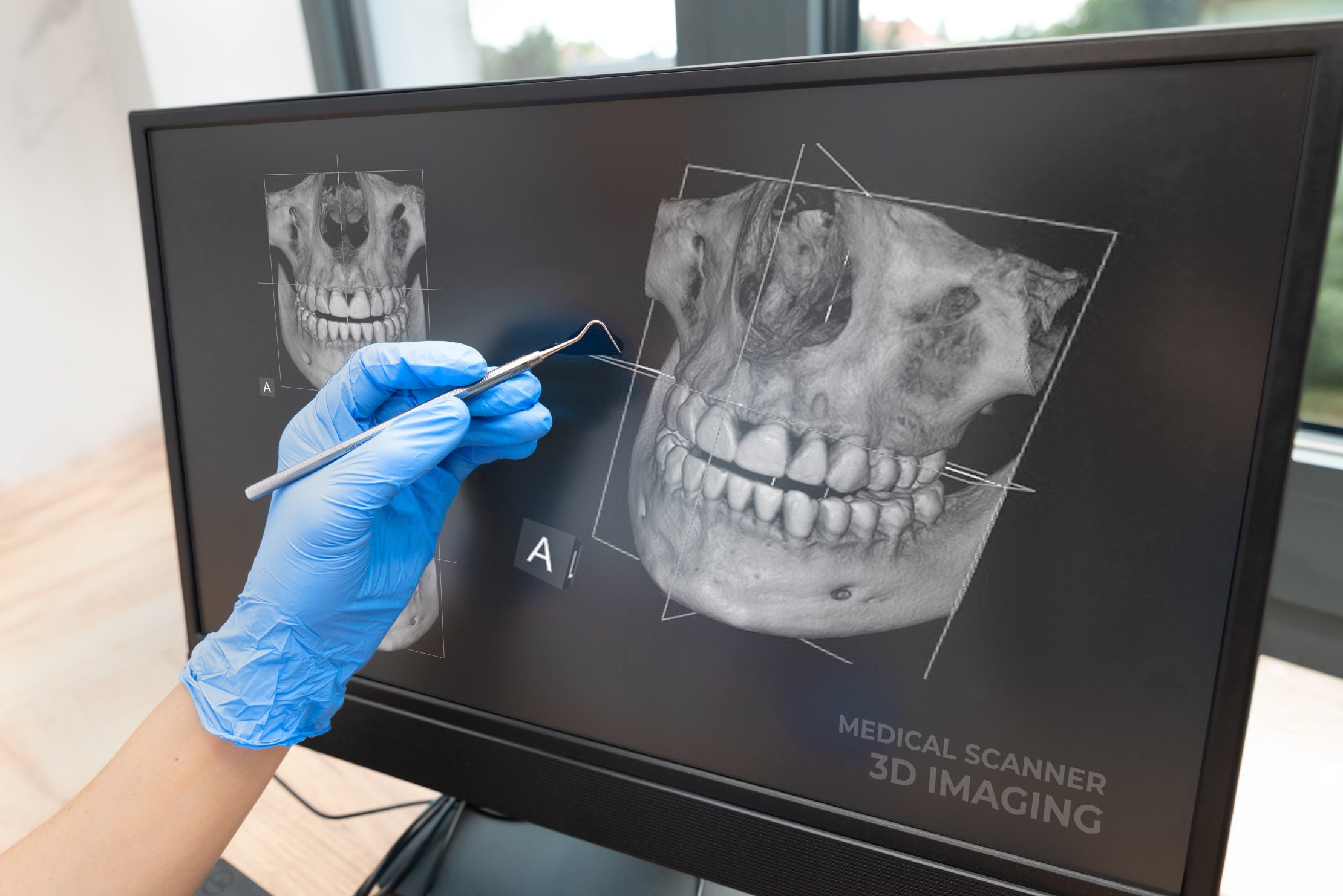 Membrane Placement & Suturing