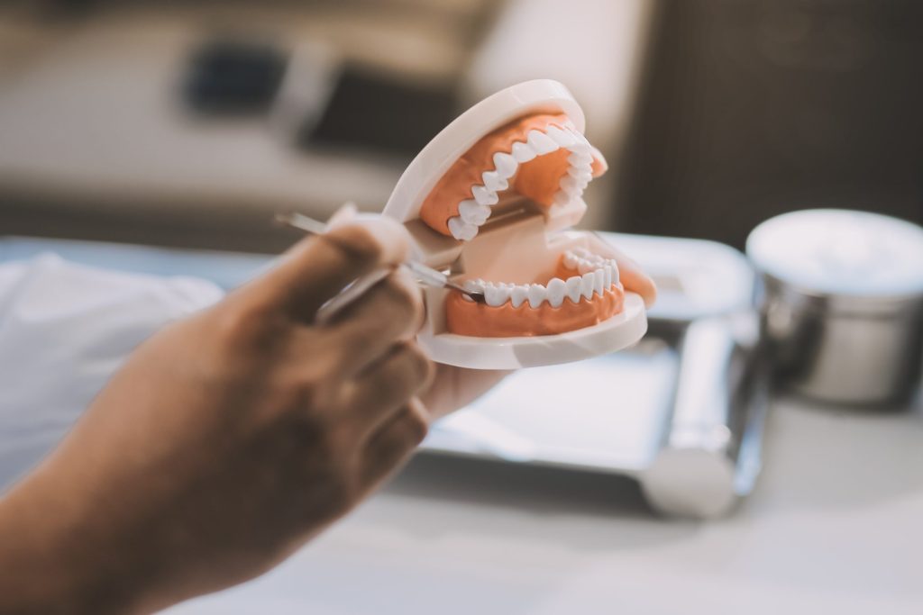 Protection for Natural Teeth
